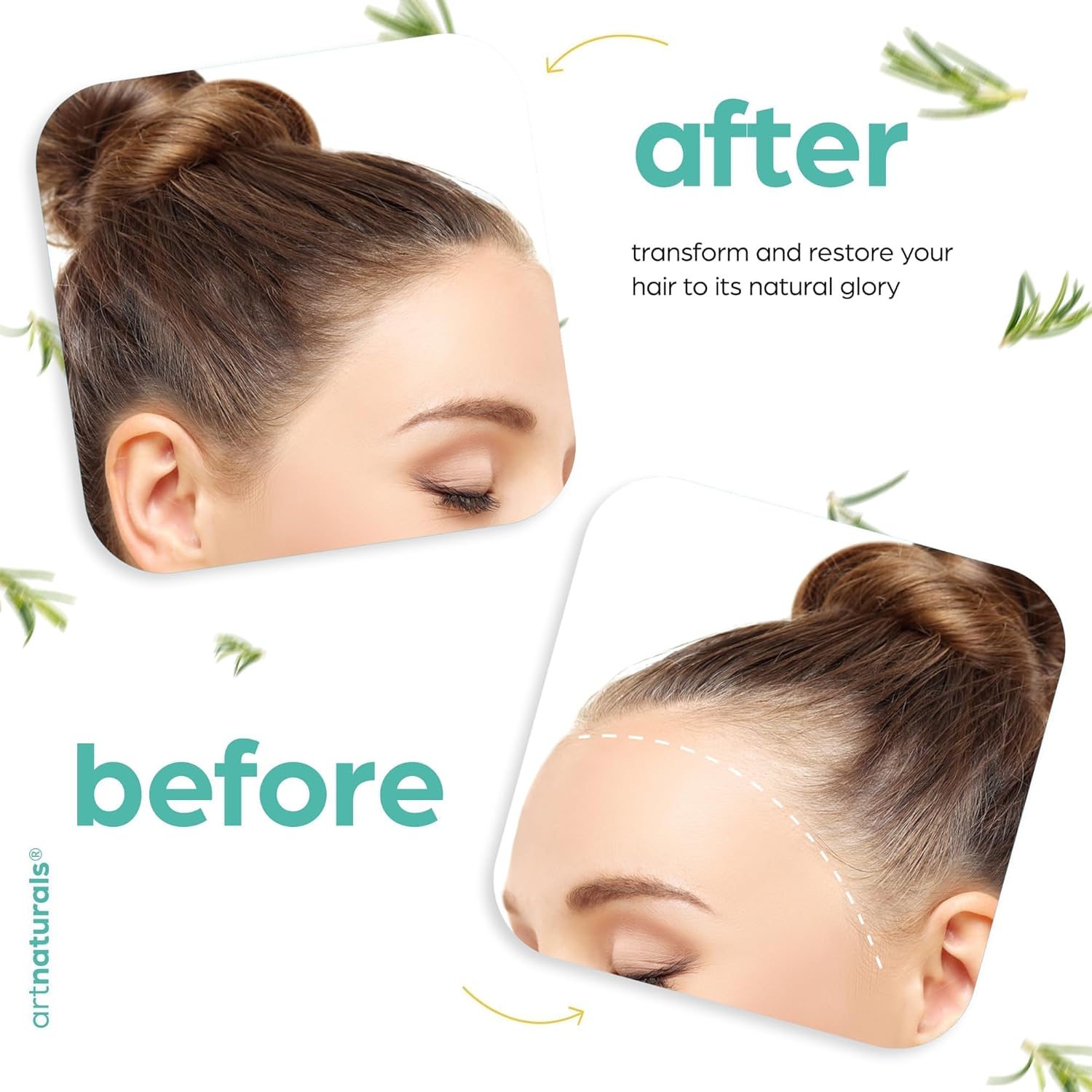 Rosemary Castor Hair Growth Oil